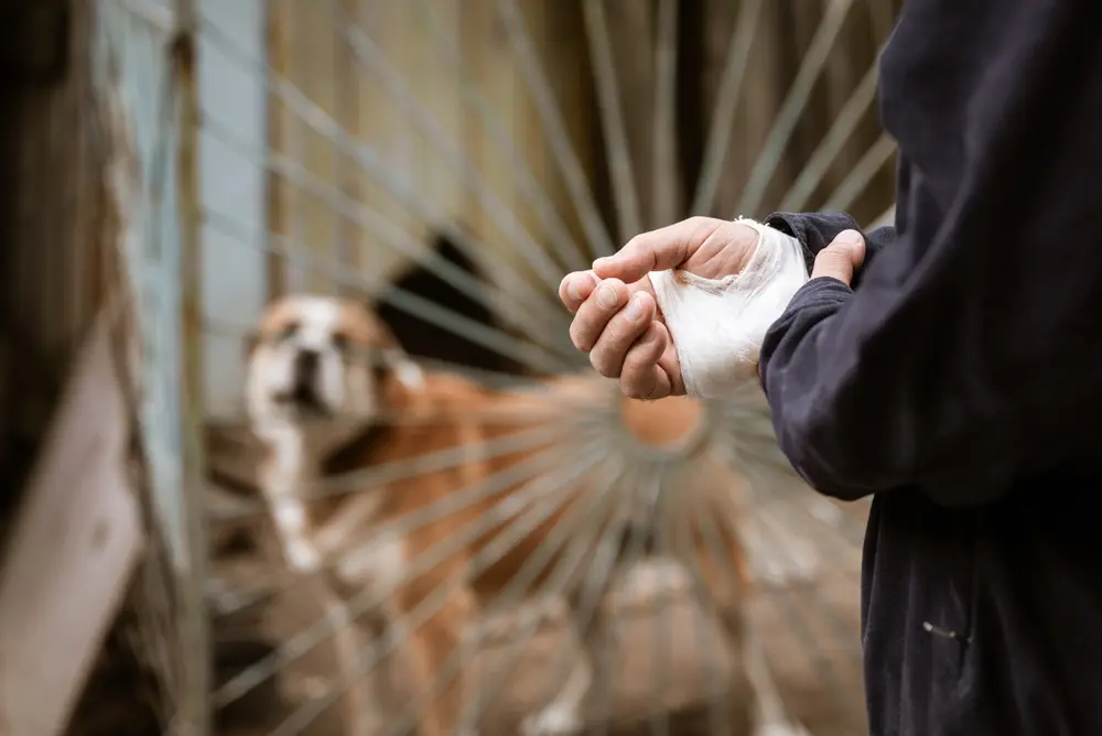 Dog Bite Injury Lawyer: California Laws, Claims, and What to Do Next